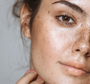 Laser and Light: How We Resurface Skin