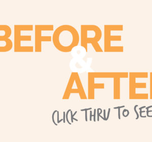 Fat Sucks. Here’s How to Get Rid of It.