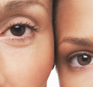 Why Retinol Is Your Go-To ‘Skingredient’