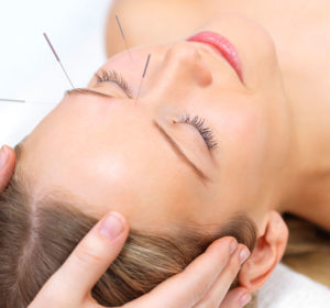 What Can Acupuncture Do for Your Skin?