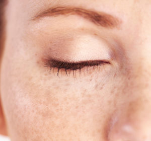 Ways Botox Turns Back the Clock Five Years (or More!)
