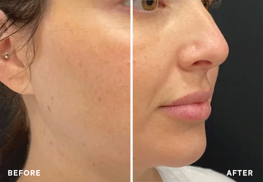 Botox BA Father Time - Make Time for You