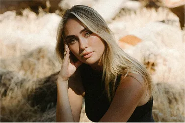 Fillers Overview 1 JUVÉDERM®