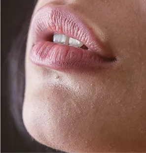 Results More 3 Results