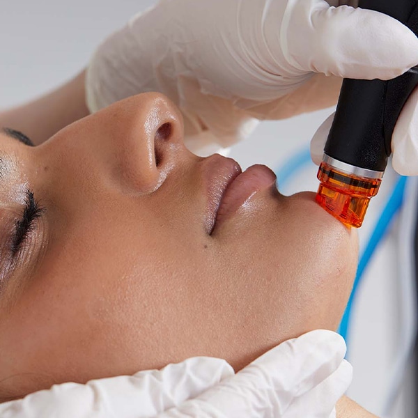 Hydrafacial-treatment-chin-close