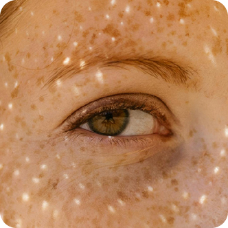 eye-closeup-lights