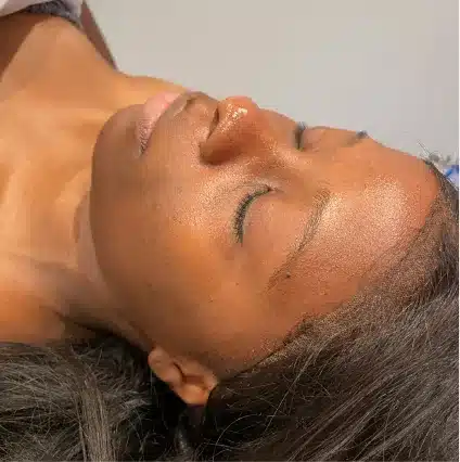 Results-Facials-After