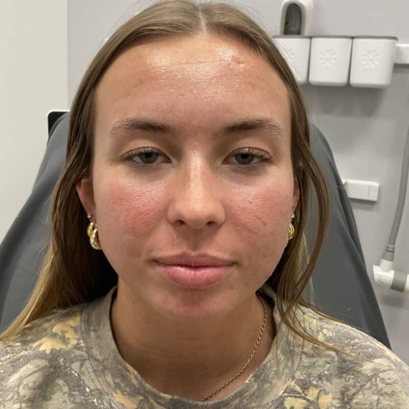before-1-mn-session