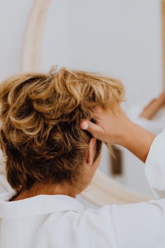 Concerns Hair thinning